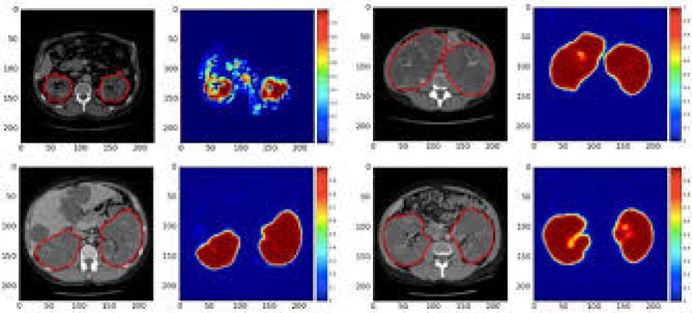 Avanços Recentes em Diagnóstico por Imagem Utilizando Redes Neurais Convolucionais